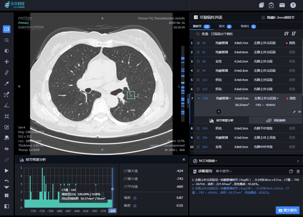 放射科智能升级肺结节/肺癌诊疗服务